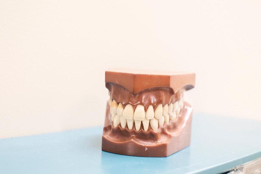 Veneers Zahnarzt Ästhetische Zahnheilkunde