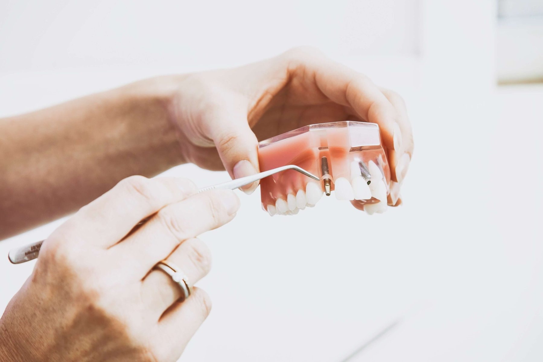 zahnimplantat dentures münchen